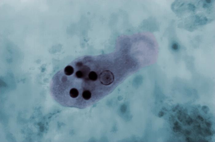 Entamoeba Histolytica Parásito Agentes Biológicos 6741