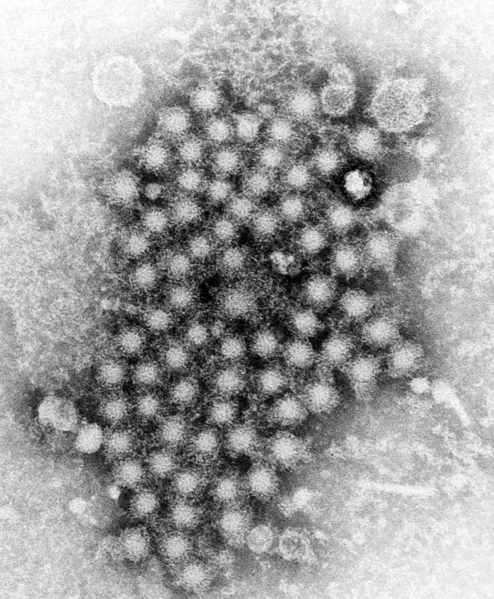 Viriones de la hepatitis. CDC Public Health Image Library (PHIL).