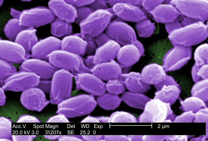 Bacillus Anthracis - Bacteria - Agentes Biológicos