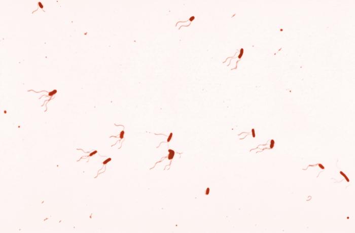 Bordetella Spp. - Bacteria - Agentes Biológicos