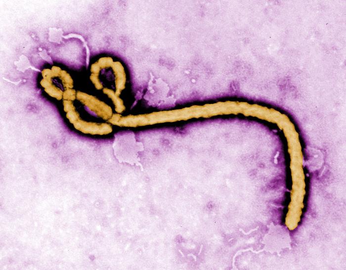 Virus Ebola. CDC Public Health Library (PHIL).
