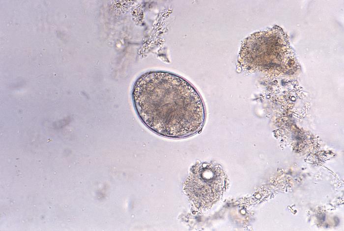 Huevo de Diphyllobothrium latum. CDC Public Health Image Library (PHIL).