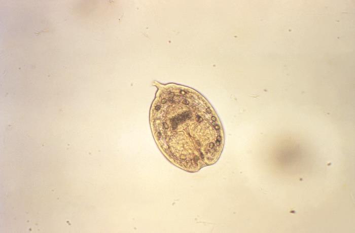 Protoescólices de Echinococcus sp. CDC Public Health Image Library (PHIL).