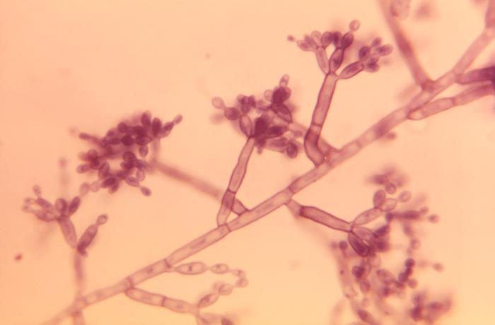 Fonsecaea pedrosoi. CDC Public Health Image Library (PHIL).
