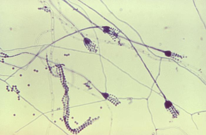 Conidios de P. frequentans. CDC Public Health Image Library (PHIL).