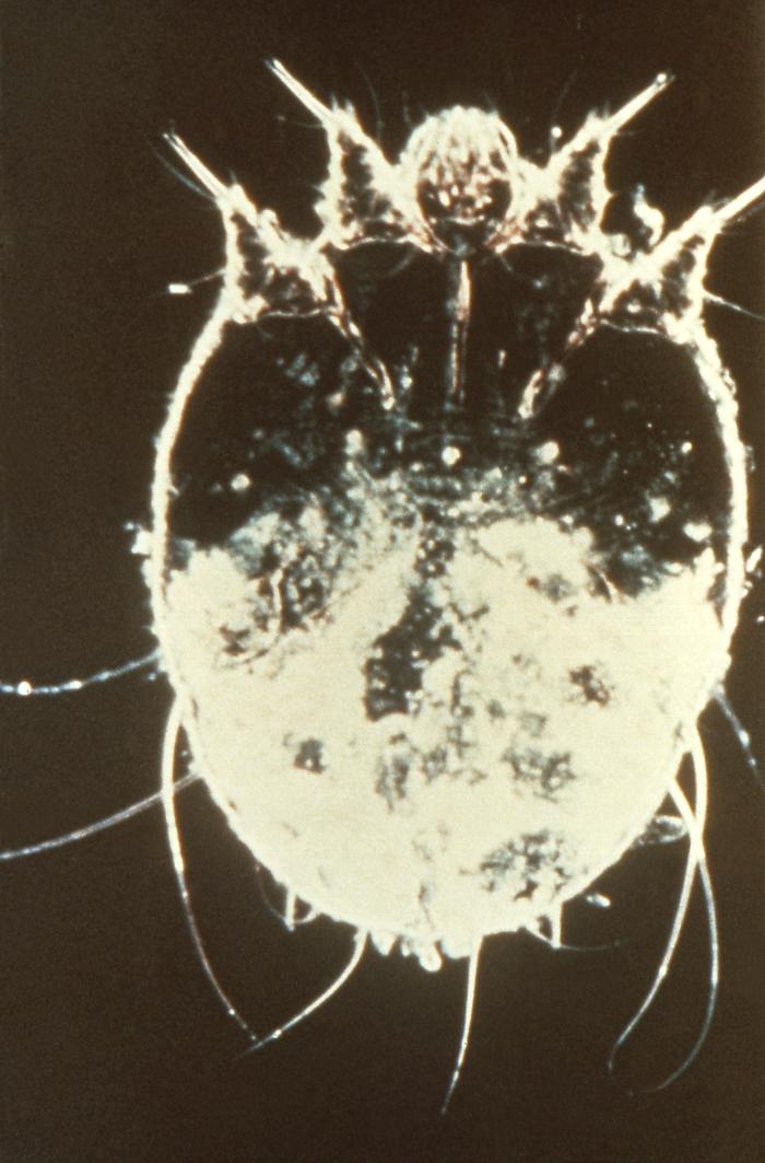 Sarcoptes scabiei var. hominis. CDC Public Health Image Library (PHIL).