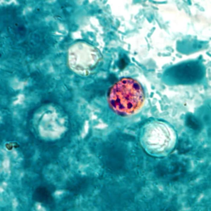 Cyclospora Cayetanensis Agentes Biológicos Parásito 3800