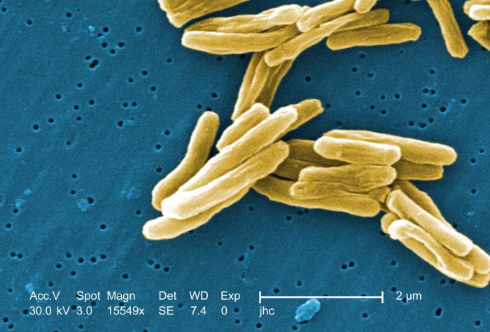 M. tuberculosis. CDC Public Health Image Library (PHIL).