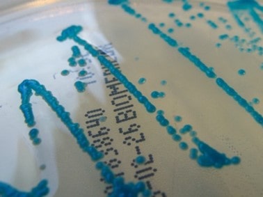 Cultivo de C. dubliniensis de Nathan Reading