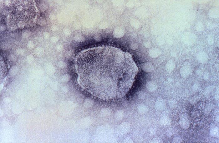 Virión de Arenavirus. CDC Public Health Image Library (PHIL). 