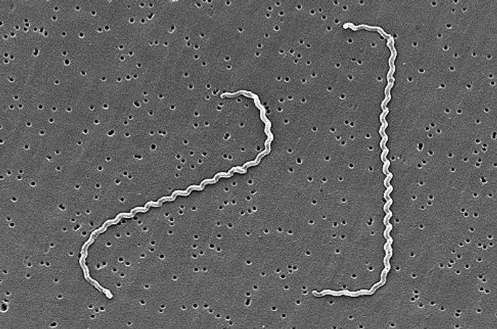 Leptospira Interrogans Agentes Biológicos Bacteria