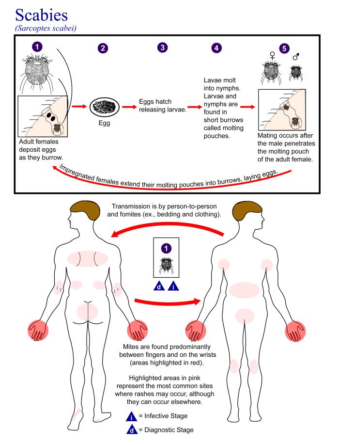 Ciclo de vida de Sarcoptes scabiei. CDC Public Health Image Library (PHIL).